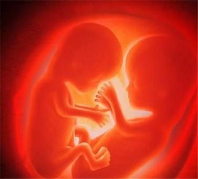 几个月做羊水穿刺 bf89ecb157b245b9b1a4153695ecea21.jpeg