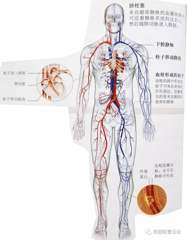 在心或动脉中的血凝块可达到全身任何部位的血管中,阻断血循环.