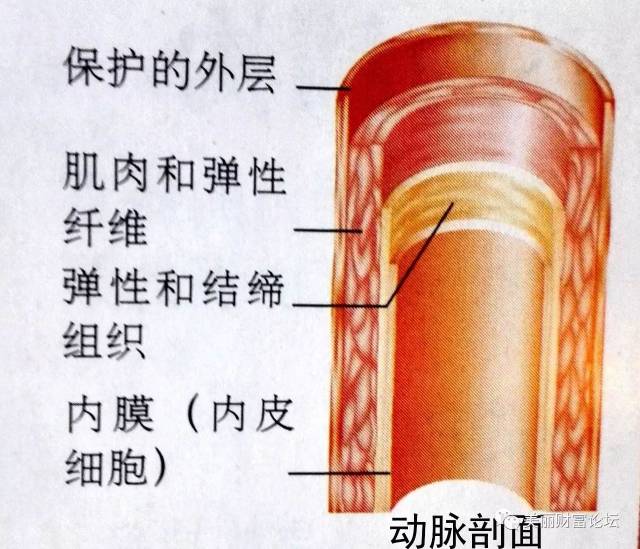 体内多余的血脂会渗透到血管内壁(内膜),在内壁下沉积,形成脂质斑块