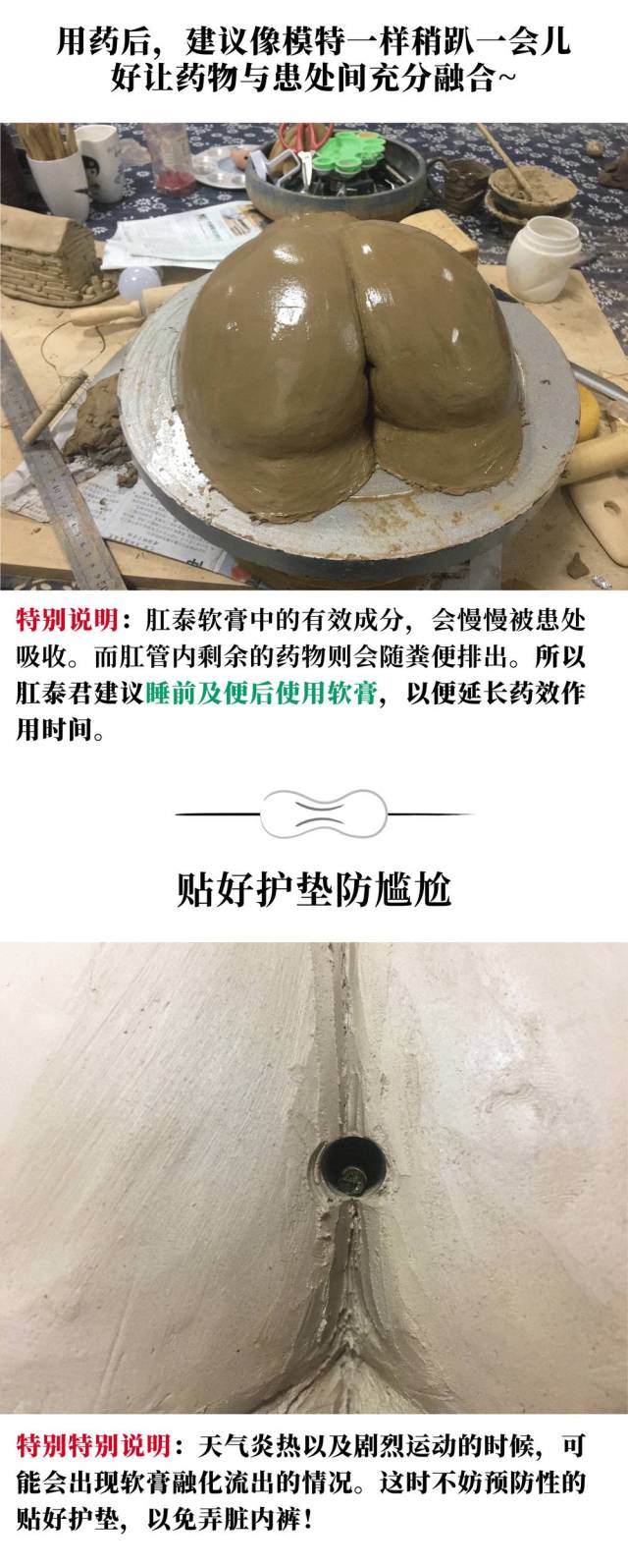 当推药器送入80%后,挤捏感概软膏, 并逐渐后撤,直至退回肛门口外.