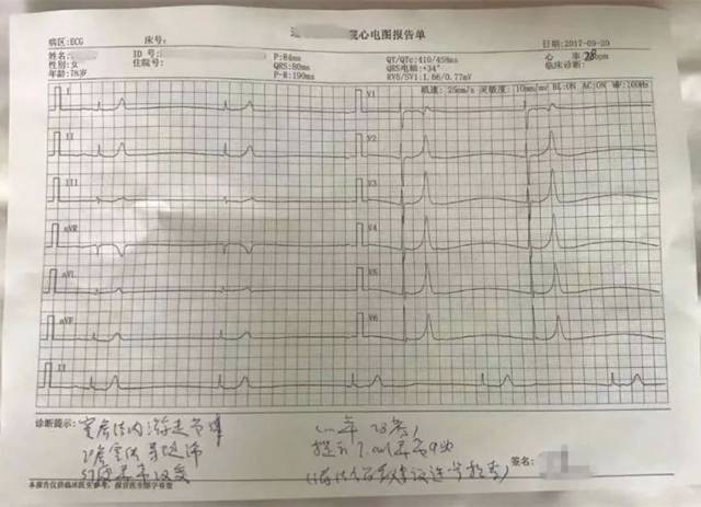 主任孙金坡立即决定对患者进行临时起搏器置入