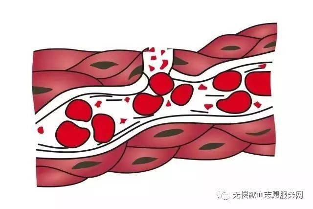 血小板附着于血管壁并凝集成块,以达初步止血作用 4凝血