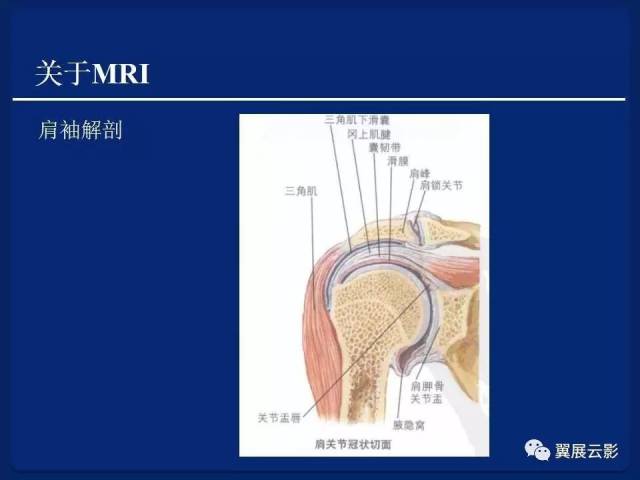 高清图解肩袖撕裂类型