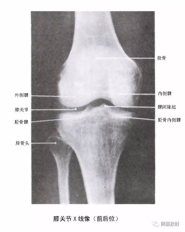 【解剖】膝关节系统解剖图 矢状mri 示意图