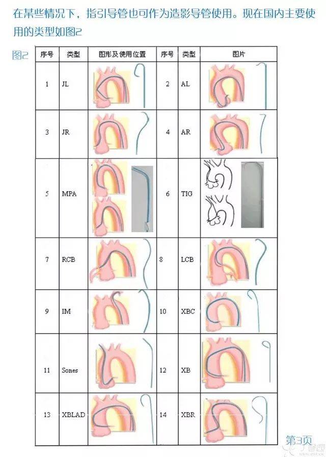 介入入门:图解造影导管的选择