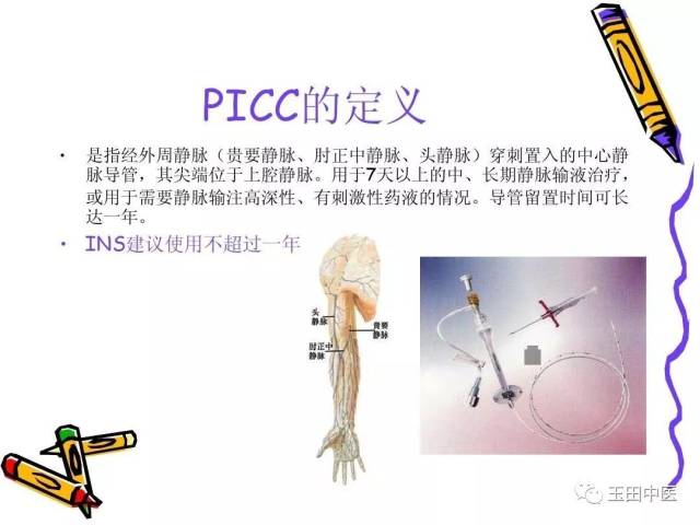 实施超声引导下picc置管术,成功将导管从患者贵要静脉送至上腔静脉