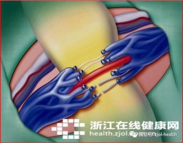 怀不上二胎,睾丸还多了一个!TA是男性不育头号杀手