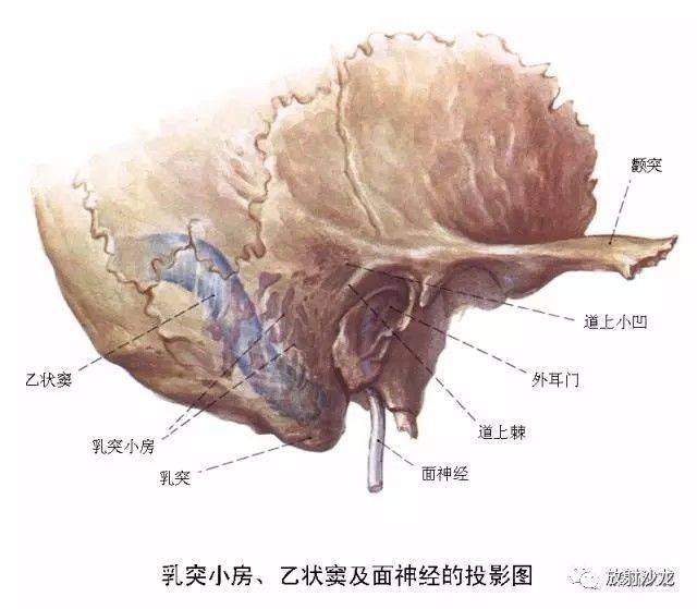 【解剖】颞骨大体解剖 轴位及冠状位ct断层图像