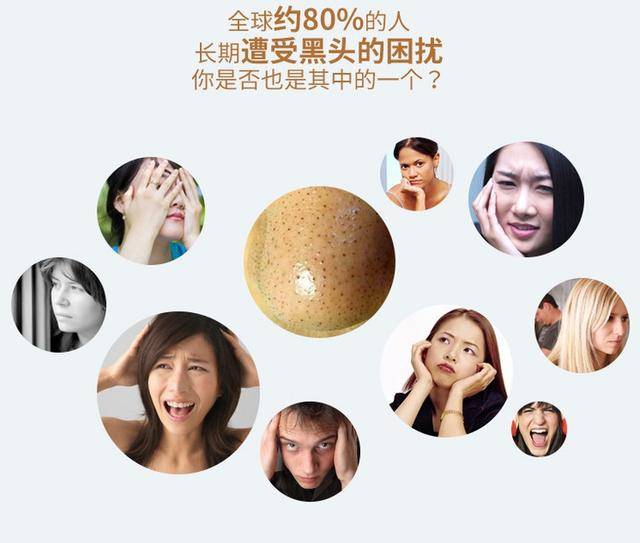 脸上有黑头怎么办?脸上长粉刺如何去除