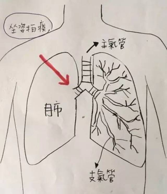 孩子咳嗽有痰,学会拍痰再也不怕憋红小脸(附清晰手绘笔记,快收藏)