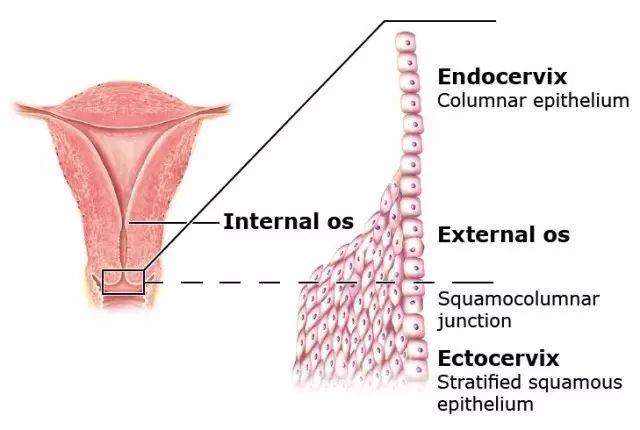 宫颈分为颈管部和宫颈阴道部,颈管内的上皮是有分泌功能的柱状上皮