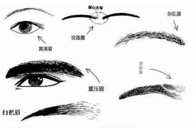 六害之眉: 指交连,黄薄,交加,杂乱,重压,扫把眉 「交连眉」连眉大家