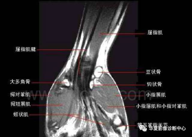 高清腕关节解剖图