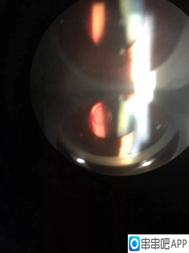 在眼科裂隙灯显微镜下拍摄到的眼球腔内"珍珠"照片