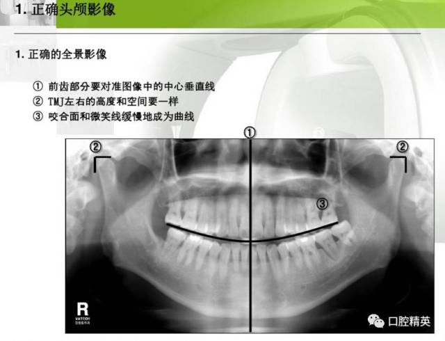 牙片机拍摄程序定位