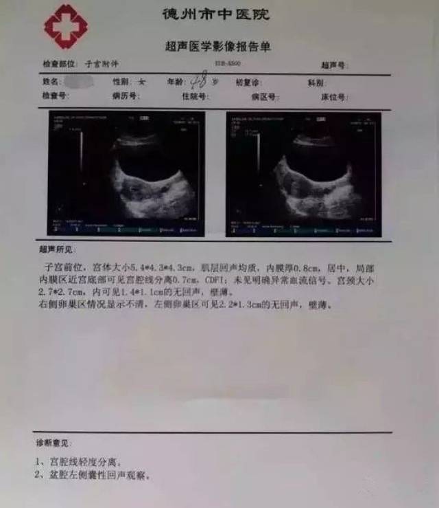 宫颈囊肿是宫颈炎慢性病变的一种,多数无明显症状,而伴随宫颈炎发作