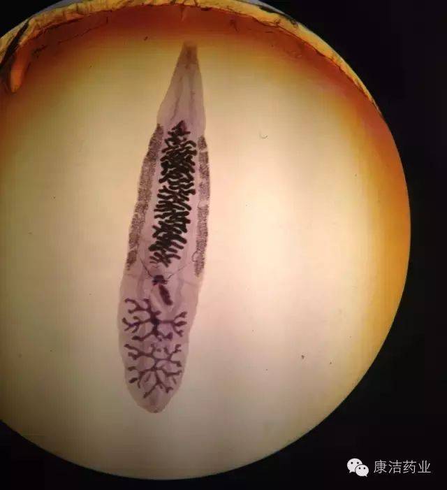 成虫寄生于人体的肝胆管内,可引起华支睾吸虫病(clonorchiasis ),又称