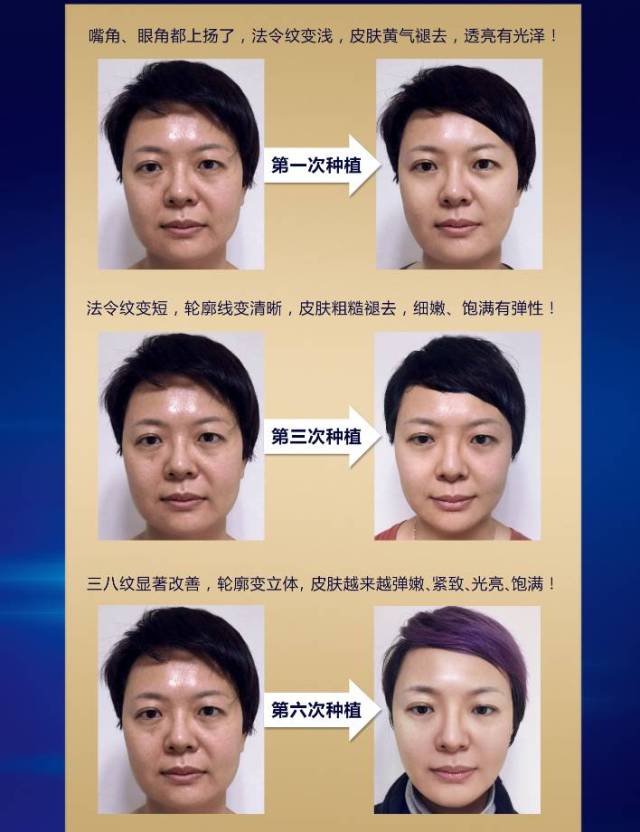 科丽娇芙霜藏针,激活皮肤年轻内生的发动机