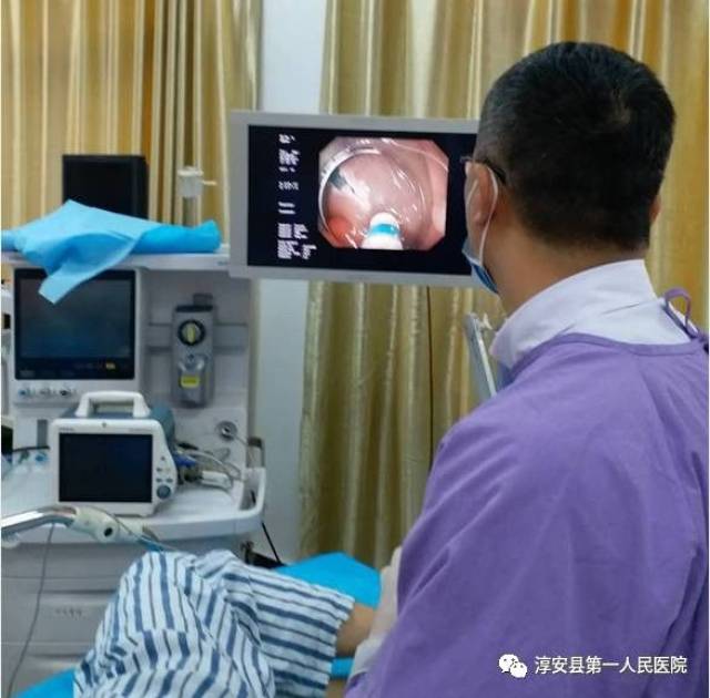 我院消化内科完成首例肠镜下肠息肉黏膜剥离术(esd)