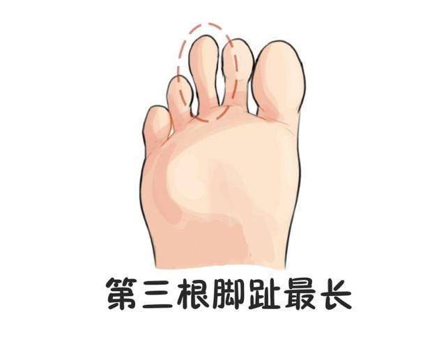 这三种好命的脚趾!你中了哪一个?恭喜!