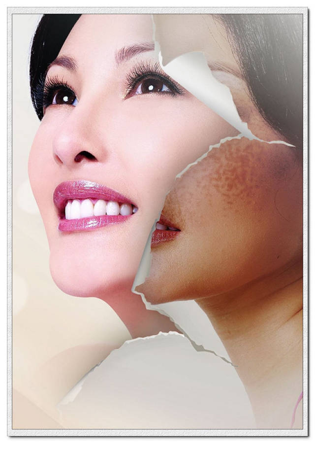 眼睛出现细纹、黄褐斑等皮肤问题出现该怎么办