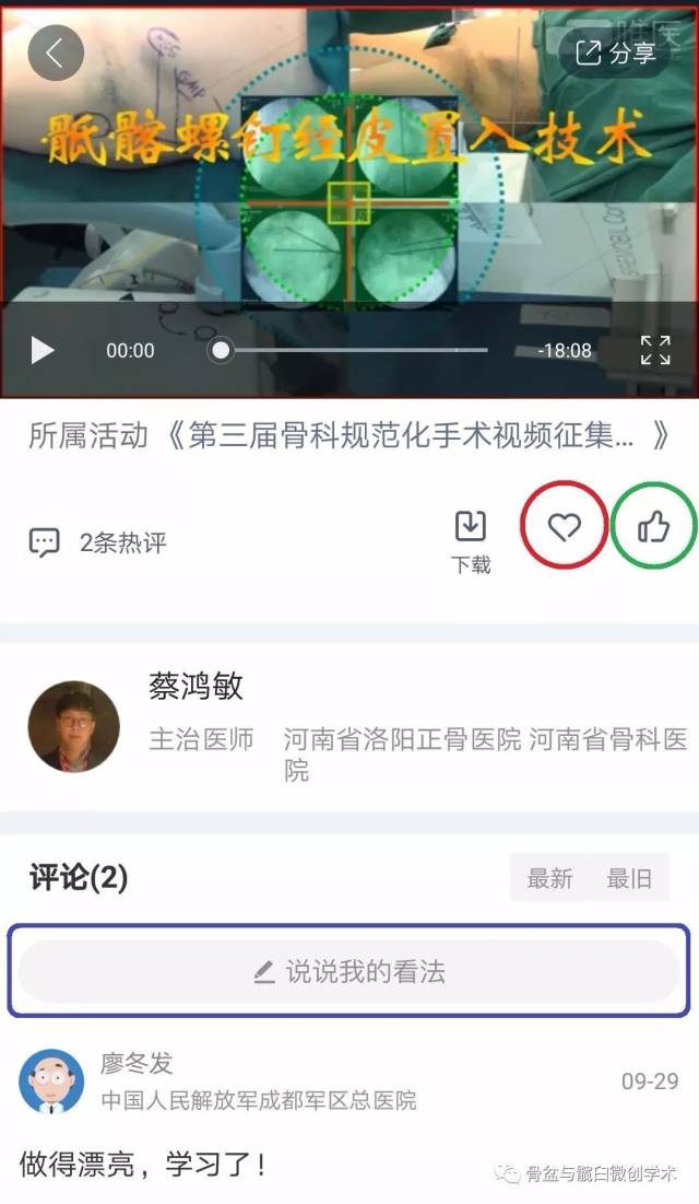 《骶髂螺钉经皮置入技术》 —— caos第三届规范化手术视频大赛第一稿