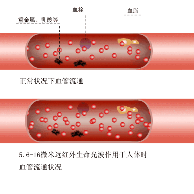 血栓一旦形成,将会减缓或者阻断正常的血流,甚至脱落移行到其它器官.