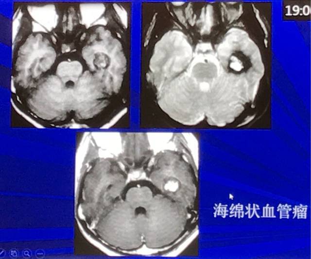 有什么病不能做磁共振 2fc354d51cd14bae927fc5f87f6d8df1.jpeg