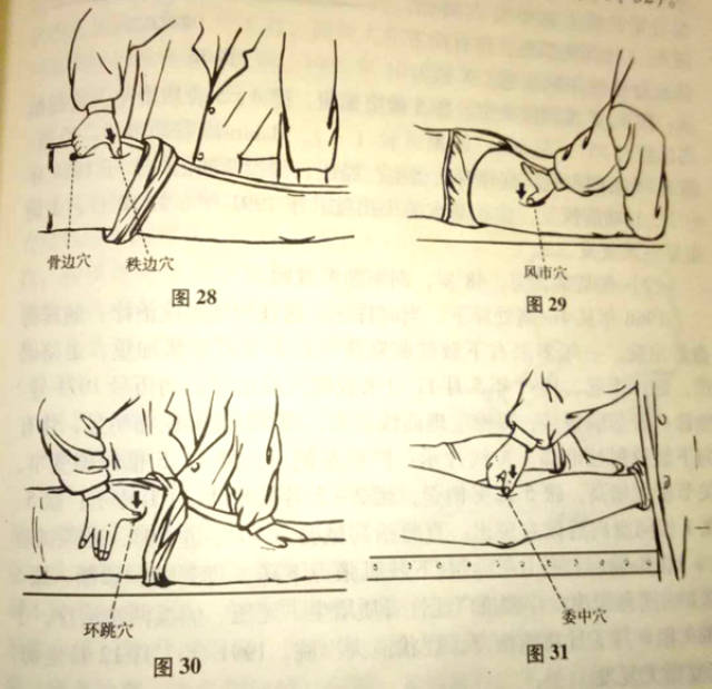 中医正骨:手法治疗腰椎间盘突出