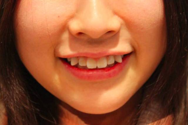 在乱牙中,对称的虎牙可谓是 "八重齿"的最高境界,微笑时就能露出那个