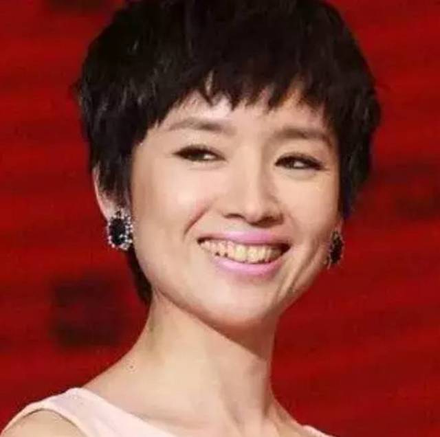 这是明星入门级整容术吧?