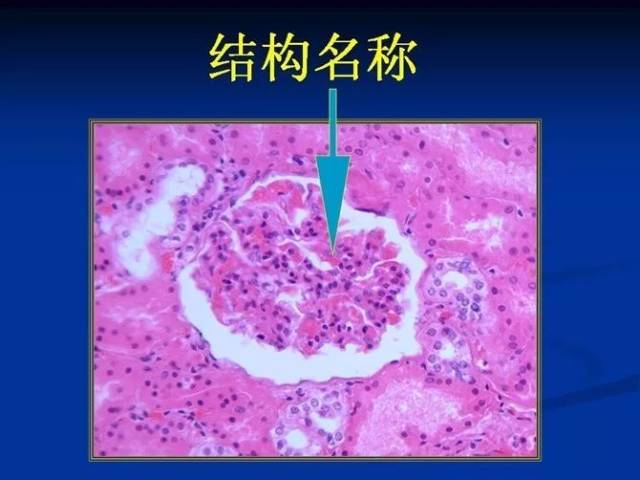 照片名称:45肾小体