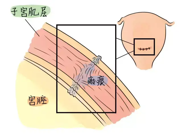 检查发现,腹中胎儿竟然