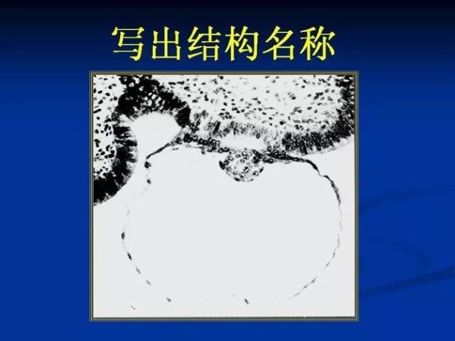 合集| 组胚实验考试模拟图65张(含答案)