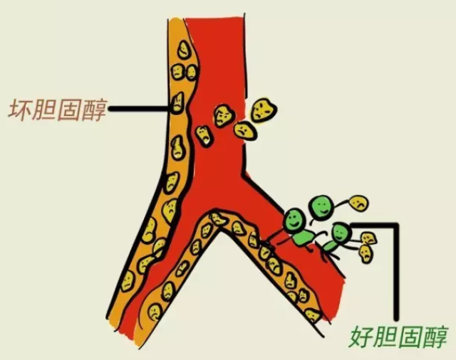 胆固醇降到正常后,是不是被堵的血管就恢复正常了呢?