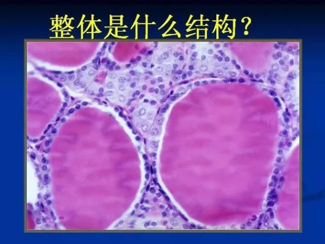 照片名称:25甲状腺滤泡