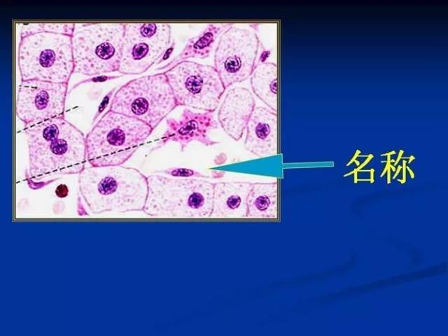 照片名称:42肝血窦
