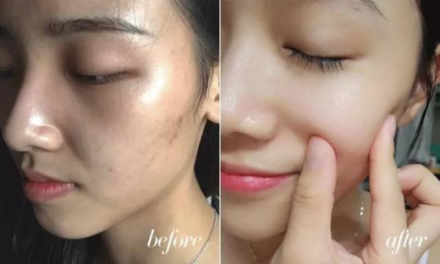 紧急通知：“皮肤鸦片”正在坑害千万女人！这些海淘护肤品有毁脸风险！