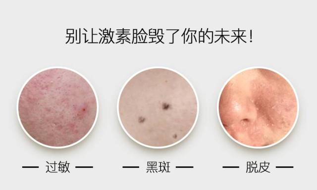 紧急通知：“皮肤鸦片”正在坑害千万女人！这些海淘护肤品有毁脸风险！