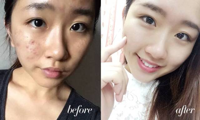 紧急通知：“皮肤鸦片”正在坑害千万女人！这些海淘护肤品有毁脸风险！