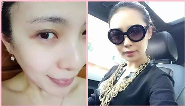 紧急通知：“皮肤鸦片”正在坑害千万女人！这些海淘护肤品有毁脸风险！