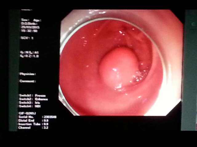 什么时候检查卵泡最好最准确 5acf26c7dcc643769d7b9a137f88dd83.jpeg