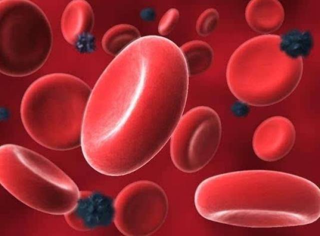 血脂怎么排出 90e2477521164648ba724b1ce55adb93.jpeg