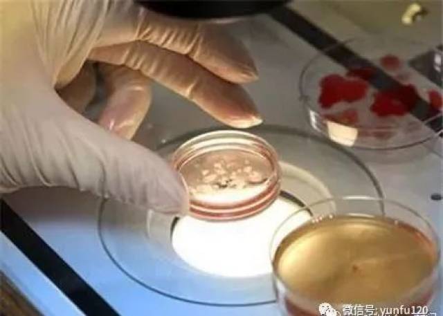 取卵完了需要注意些什么?