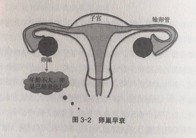 1卵巢早衰的表现