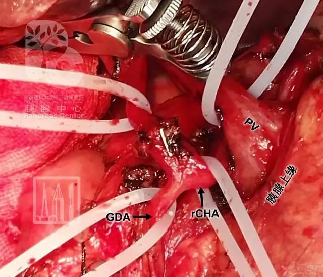 精彩手绘图 轻松学解剖:肝动脉之舞