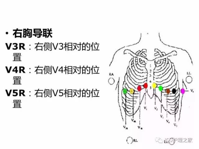 心电图机的操作,12导联,18导联链接详解!