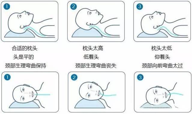 合适的枕头高度,图片来源于儿科医师专业资料库 2.