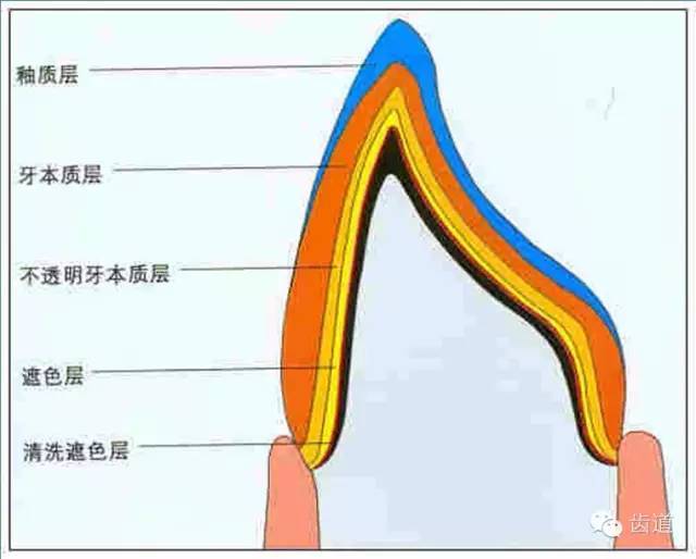 4mm 1.0-1.6mm 2.2-2.5mm 侧切牙 牙釉质 0.9mm 0.6-1.0mm 牙本质 3.