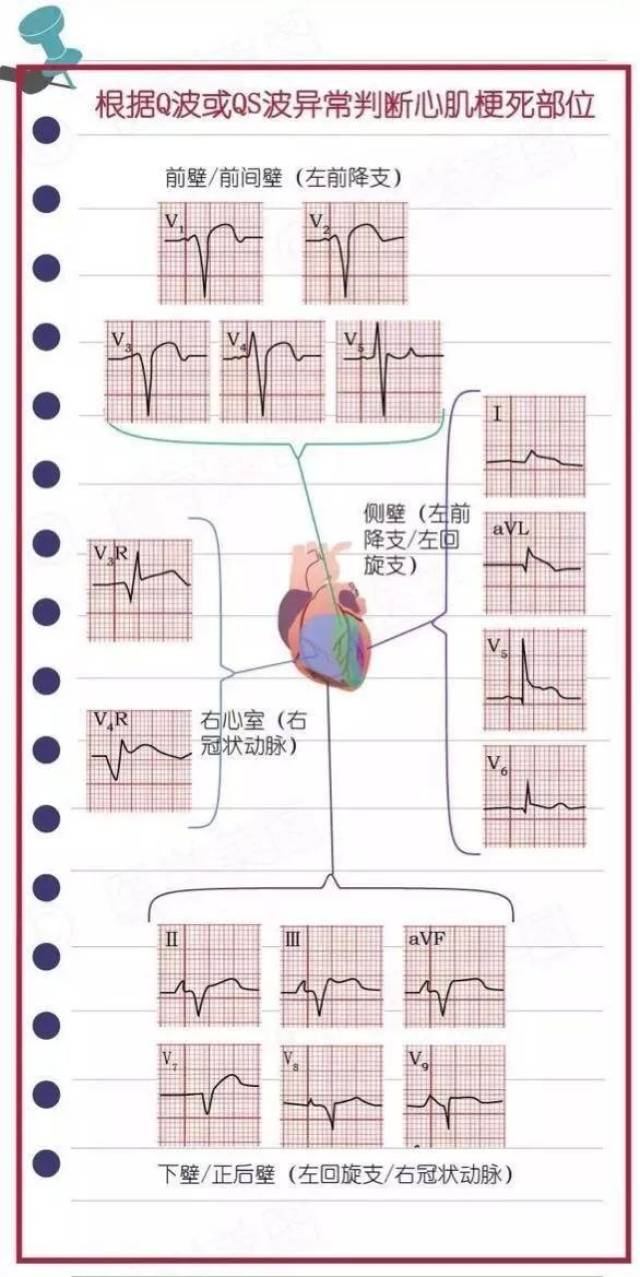 还可见于变异型心绞痛,急性心包炎,急性肺栓塞,主动脉夹层,急性心肌炎